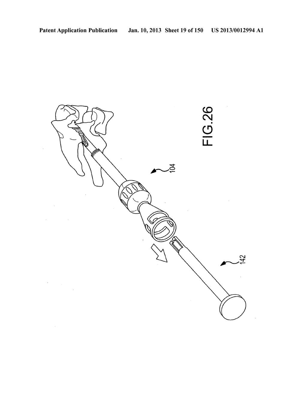 VERTEBRAL JOINT IMPLANTS AND DELIVERY TOOLS - diagram, schematic, and image 20