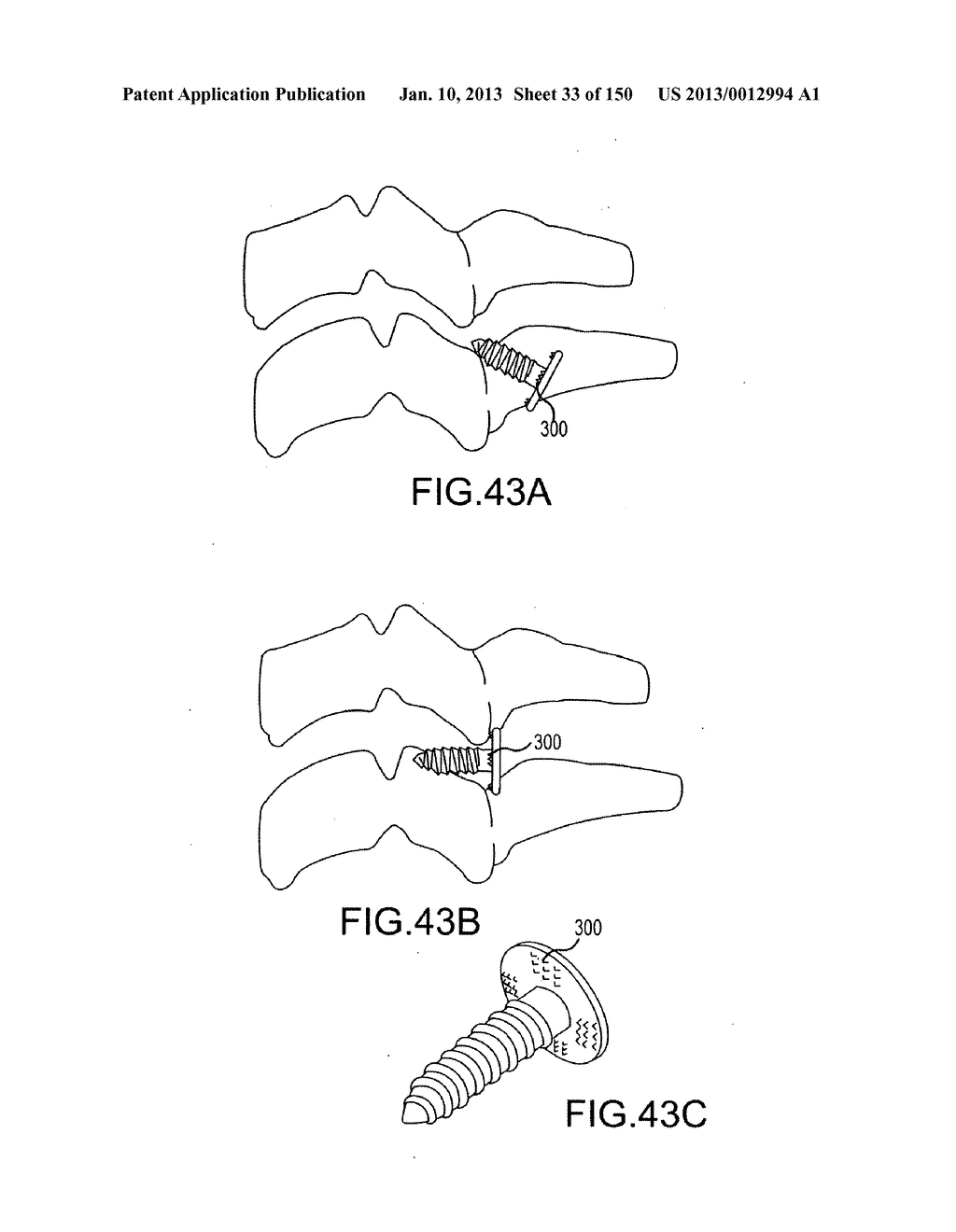 VERTEBRAL JOINT IMPLANTS AND DELIVERY TOOLS - diagram, schematic, and image 34