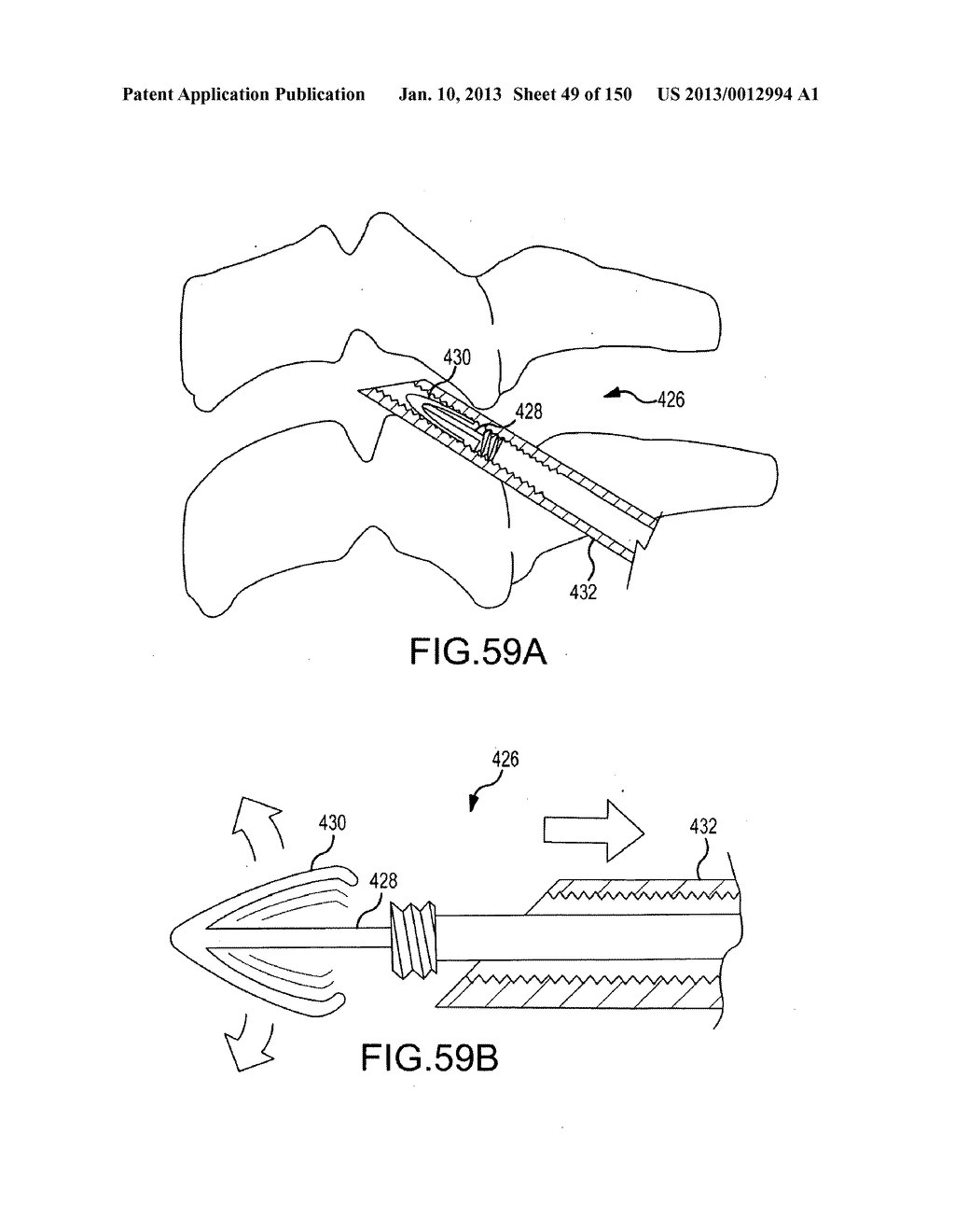 VERTEBRAL JOINT IMPLANTS AND DELIVERY TOOLS - diagram, schematic, and image 50