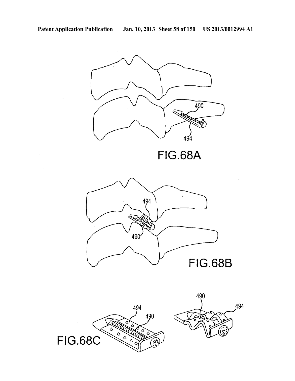 VERTEBRAL JOINT IMPLANTS AND DELIVERY TOOLS - diagram, schematic, and image 59