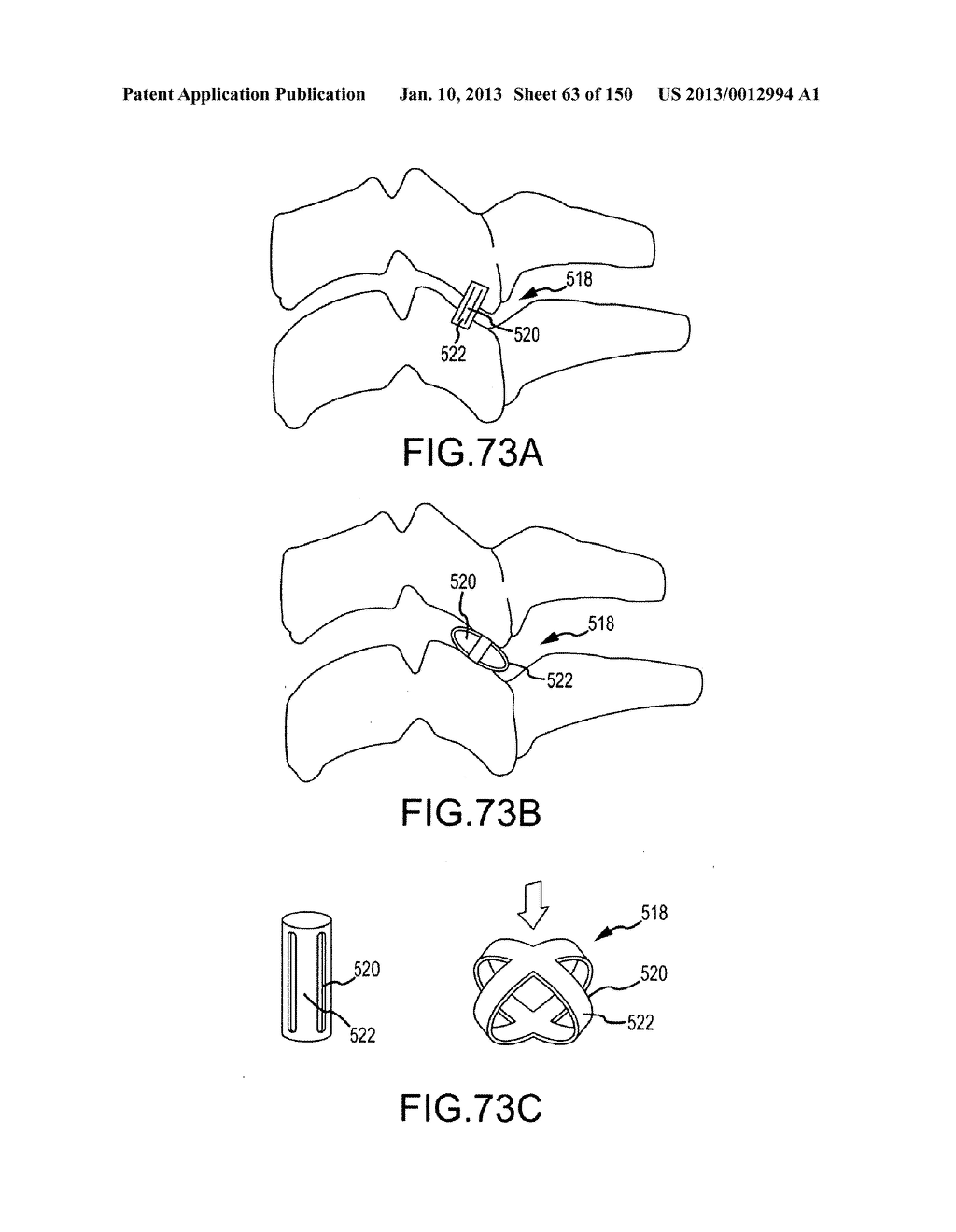 VERTEBRAL JOINT IMPLANTS AND DELIVERY TOOLS - diagram, schematic, and image 64