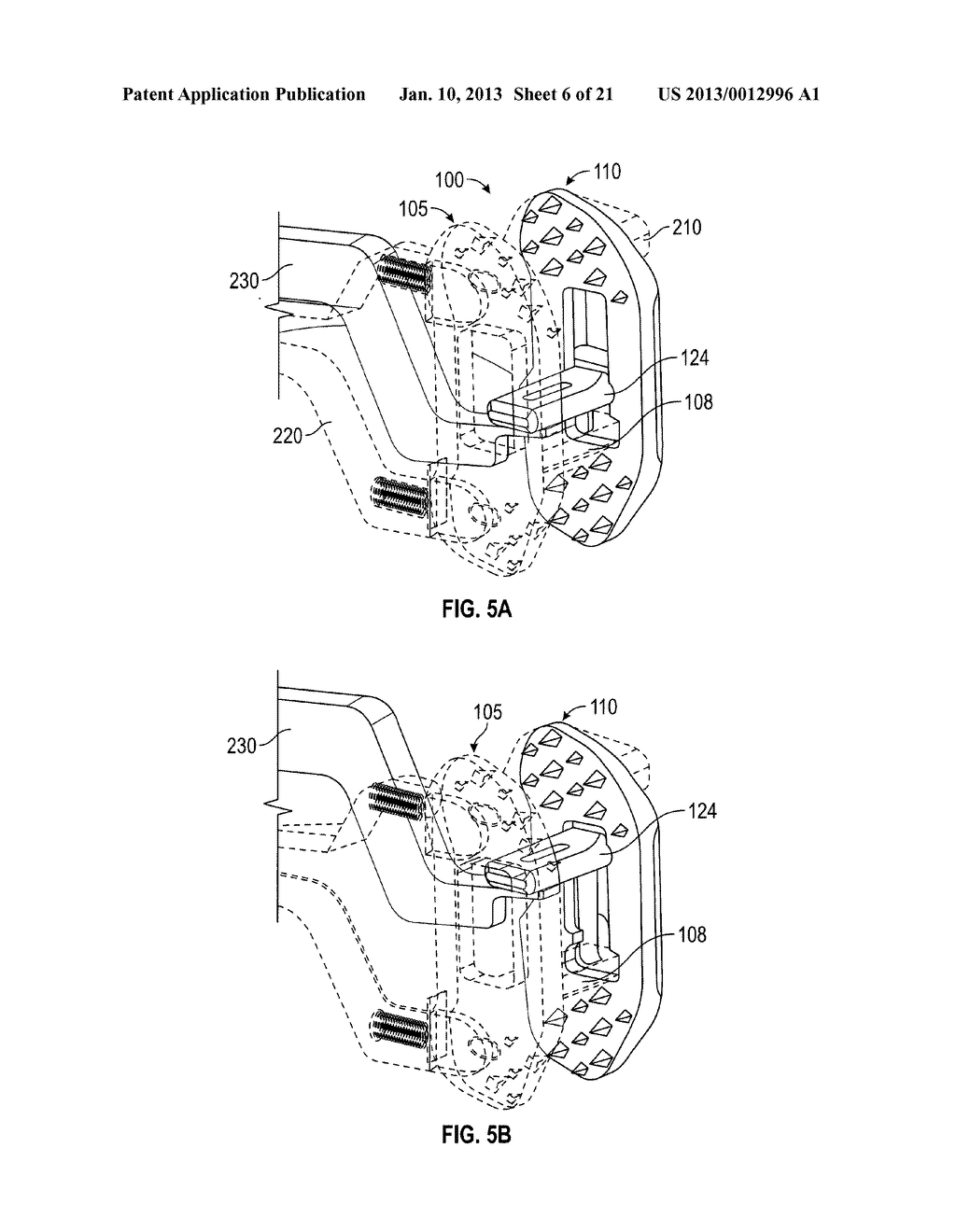 SPINOUS PROCESS DEVICE - diagram, schematic, and image 07