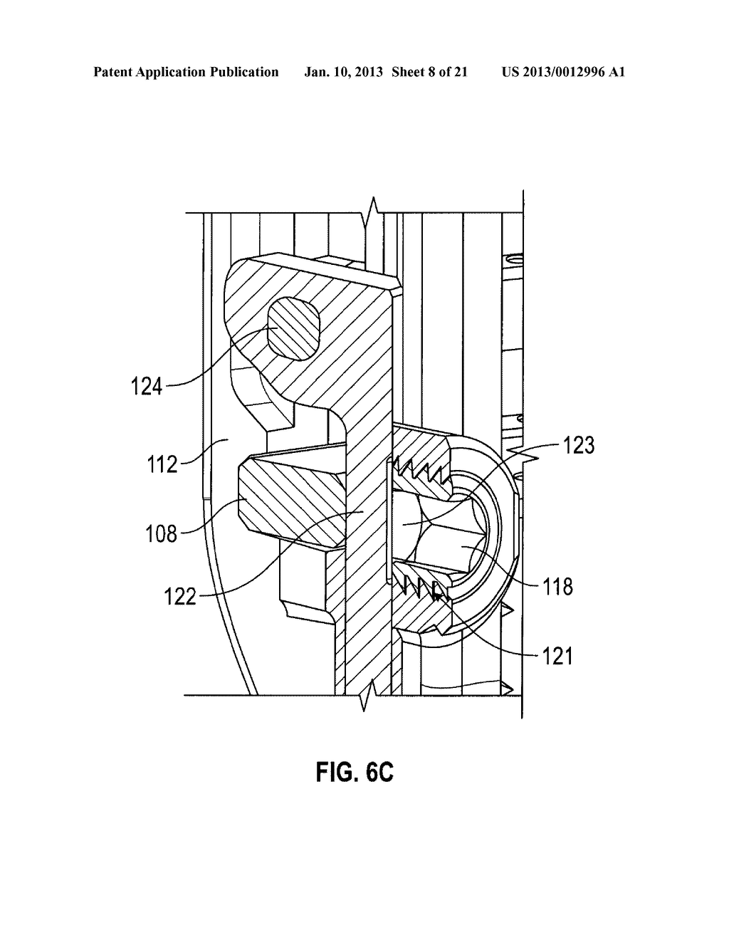 SPINOUS PROCESS DEVICE - diagram, schematic, and image 09