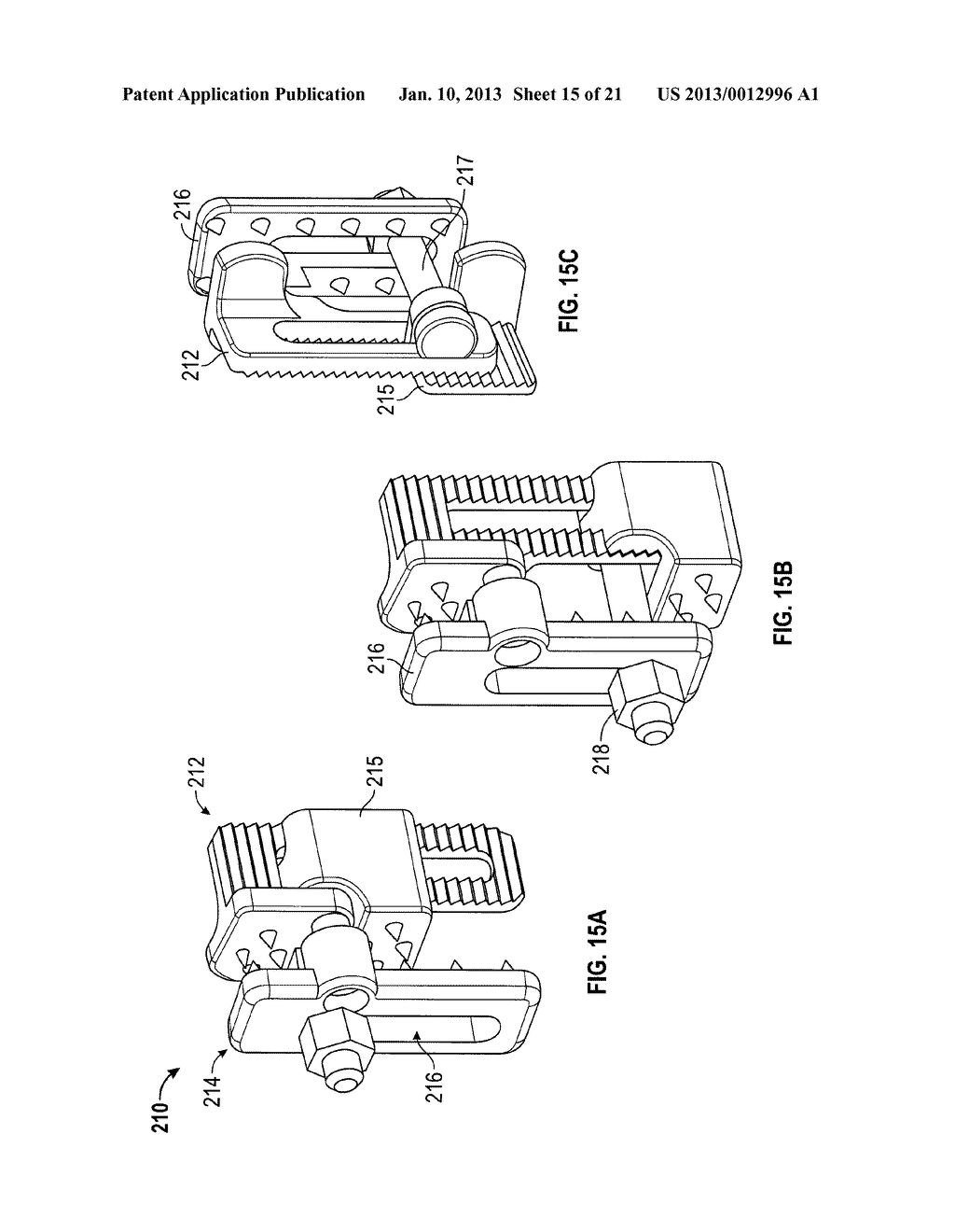 SPINOUS PROCESS DEVICE - diagram, schematic, and image 16