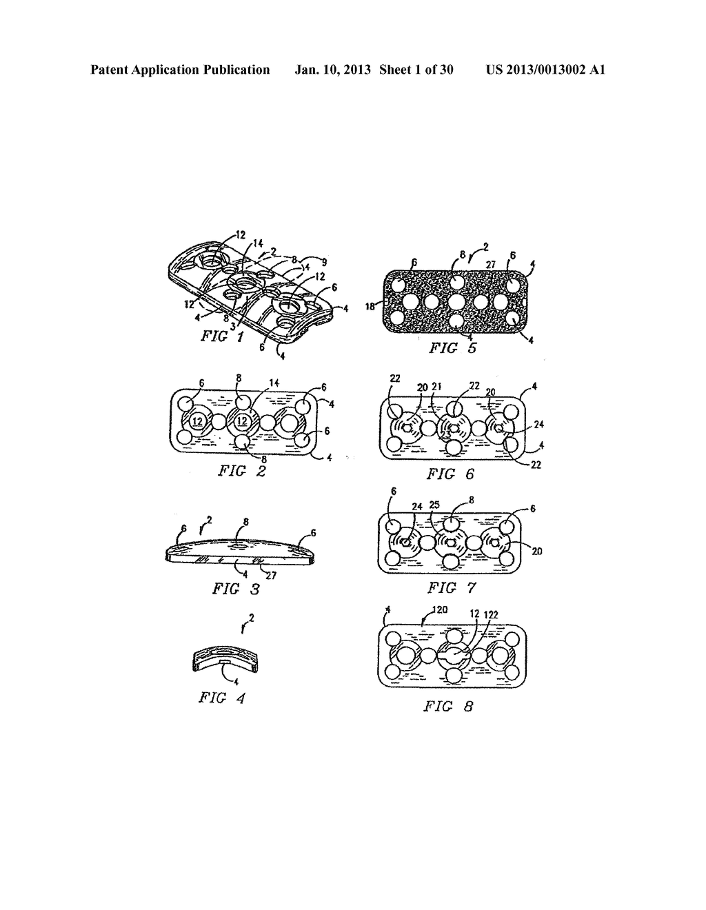 ORTHOPEDIC IMPLANT WITH LOCKING ELEMENT - diagram, schematic, and image 02