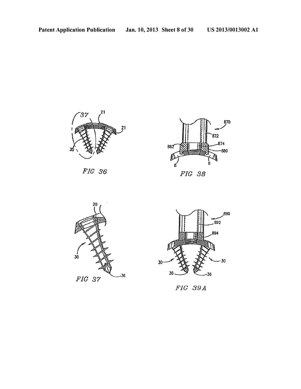 ORTHOPEDIC IMPLANT WITH LOCKING ELEMENT - diagram, schematic, and image 09