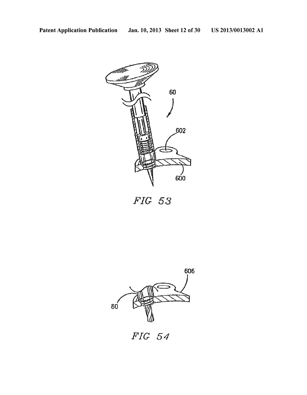 ORTHOPEDIC IMPLANT WITH LOCKING ELEMENT - diagram, schematic, and image 13