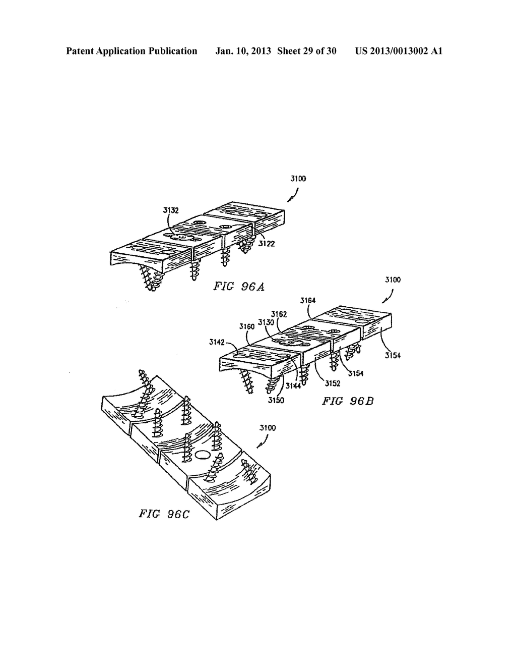 ORTHOPEDIC IMPLANT WITH LOCKING ELEMENT - diagram, schematic, and image 30