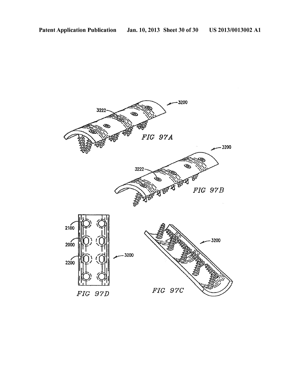 ORTHOPEDIC IMPLANT WITH LOCKING ELEMENT - diagram, schematic, and image 31