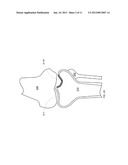 COMBINATION DIRECTIONAL AND NON-DIRECTIONAL BONE TAMP diagram and image