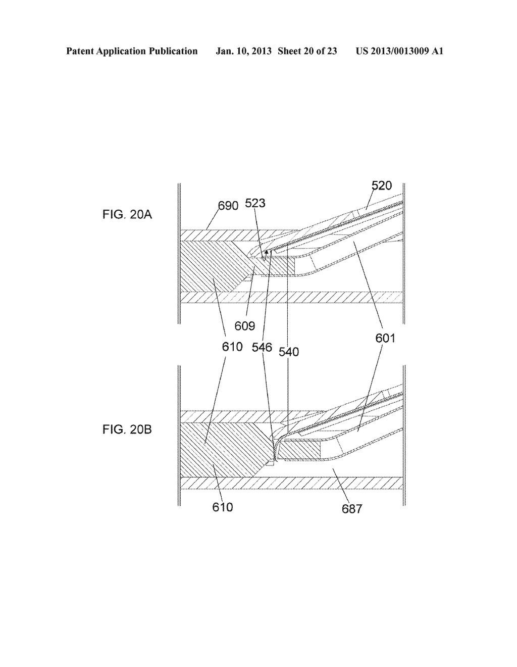 Apparatus and Methods for Separating Internal Bone Fixation Device from     Introducer - diagram, schematic, and image 21