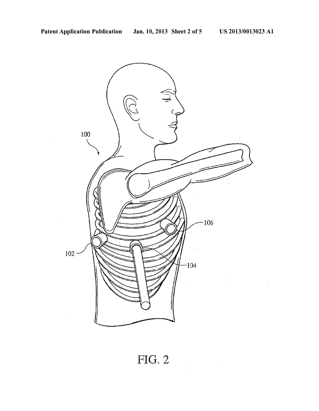 ELECTRICAL STIMULATION OF THE SYMPATHETIC NERVE CHAIN - diagram, schematic, and image 03