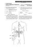 Renal Nerve Stimulation Method for Treatment of Patients diagram and image