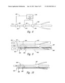 Renal Nerve Stimulation Method for Treatment of Patients diagram and image