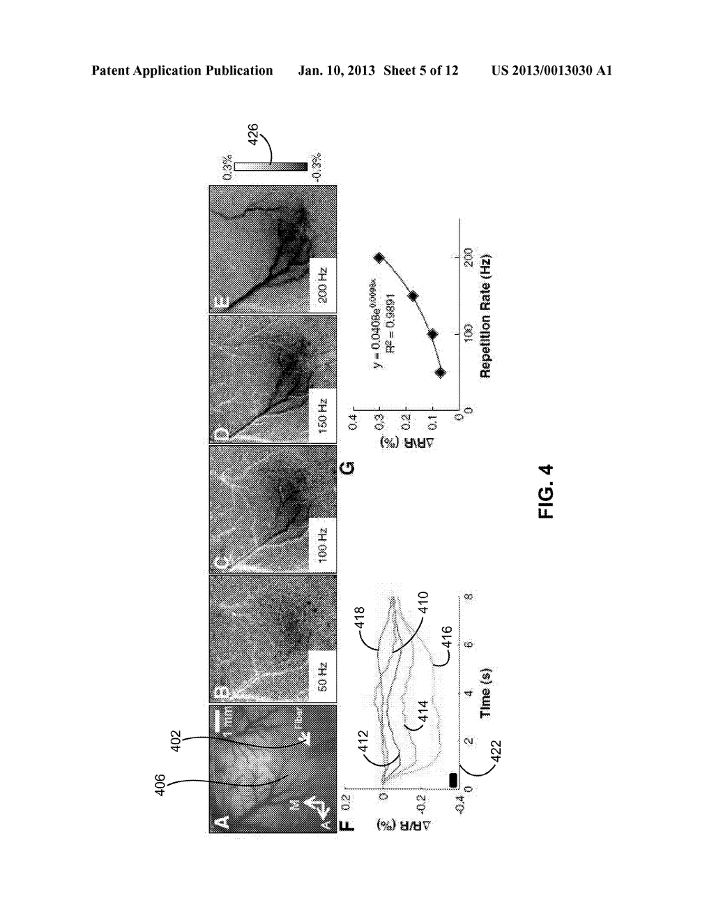 METHOD AND APPARATUS OF PULSED INFRARED LIGHT FOR THE INHIBITION OF     CENTRAL NERVOUS SYSTEM NEURONS - diagram, schematic, and image 06