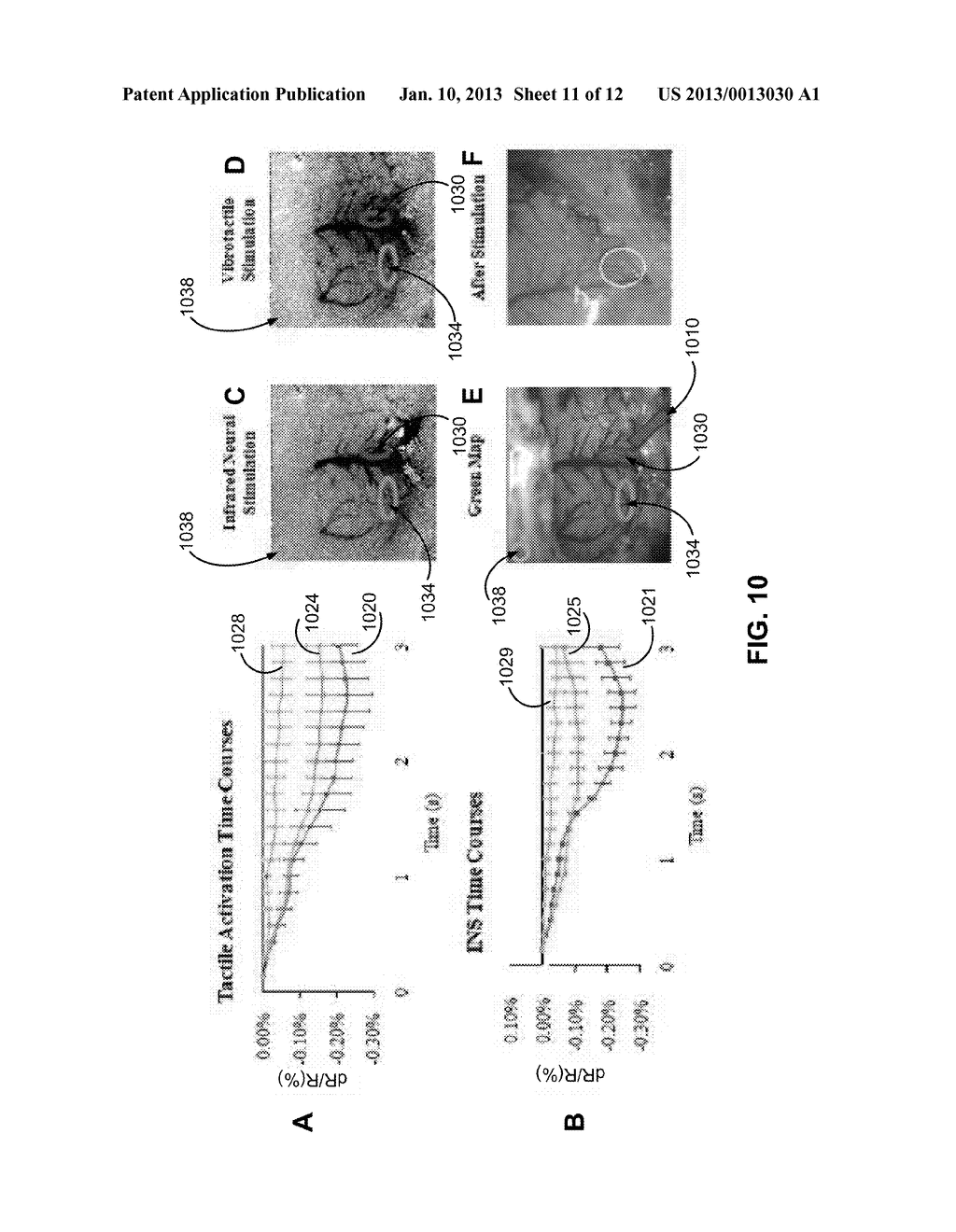 METHOD AND APPARATUS OF PULSED INFRARED LIGHT FOR THE INHIBITION OF     CENTRAL NERVOUS SYSTEM NEURONS - diagram, schematic, and image 12