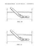 DIRECTIONAL STIMULATION LEAD AND ORIENTATION SYSTEM diagram and image