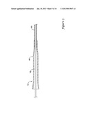 STENT DELIVERY SYSTEM diagram and image