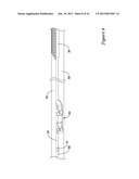 STENT DELIVERY SYSTEM diagram and image