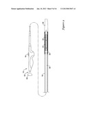 STENT DELIVERY SYSTEM diagram and image