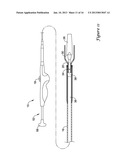 STENT DELIVERY SYSTEM diagram and image