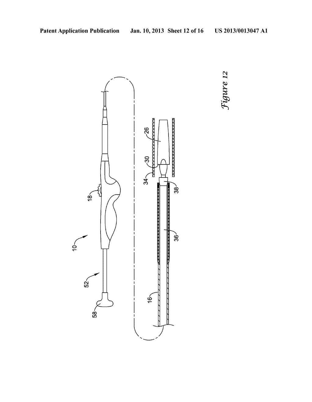 STENT DELIVERY SYSTEM - diagram, schematic, and image 13