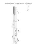 STENT DELIVERY SYSTEM diagram and image