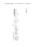 STENT DELIVERY SYSTEM diagram and image