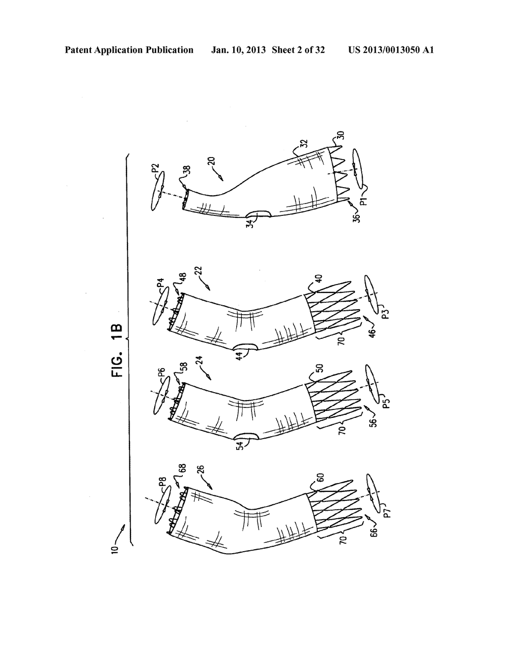 MULTI-COMPONENT STENT-GRAFT SYSTEM FOR IMPLANTATION IN A BLOOD VESSEL WITH     MULTIPLE BRANCHES - diagram, schematic, and image 03