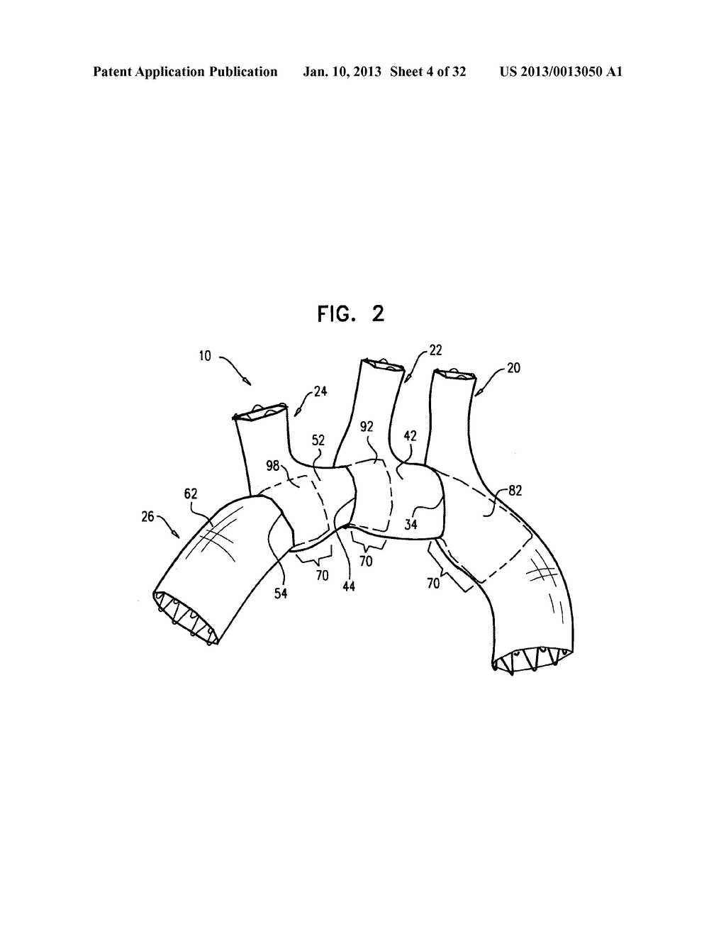 MULTI-COMPONENT STENT-GRAFT SYSTEM FOR IMPLANTATION IN A BLOOD VESSEL WITH     MULTIPLE BRANCHES - diagram, schematic, and image 05