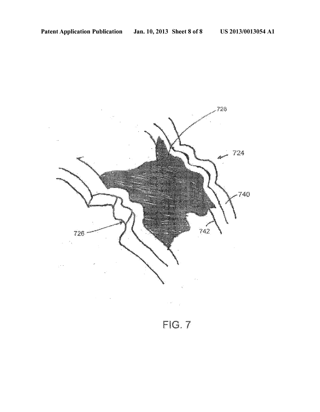 Endovascular Implant Having an Integral Graft Component and Method of     Manufacture - diagram, schematic, and image 09