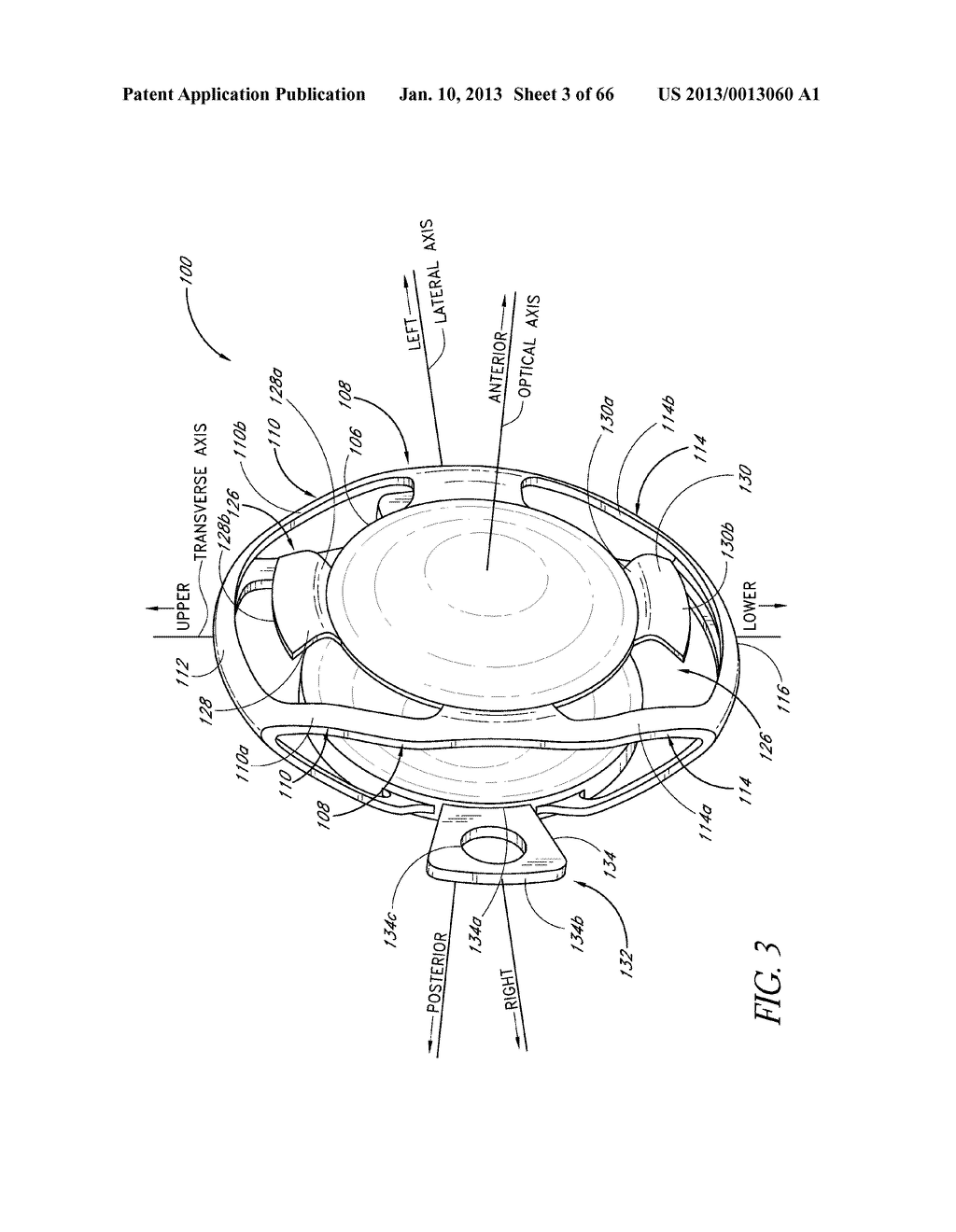 MATERIALS FOR USE IN ACCOMMODATING INTRAOCULAR LENS SYSTEM - diagram, schematic, and image 04
