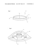 METHOD OF MAINTAINING THE STRUCTURE OF AN OPENING IN THE ANTERIOR OR     POSTERIOR CAPSULE diagram and image