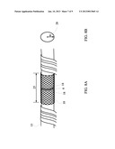 TENDON REPAIR DEVICE AND METHOD diagram and image