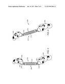 Methods and Devices for Joint Load Control During Healing of Joint Tissue diagram and image