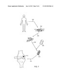 Methods and Devices for Joint Load Control During Healing of Joint Tissue diagram and image