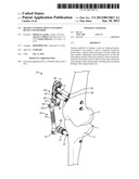 Transcutaneous Joint Unloading Device and Method diagram and image