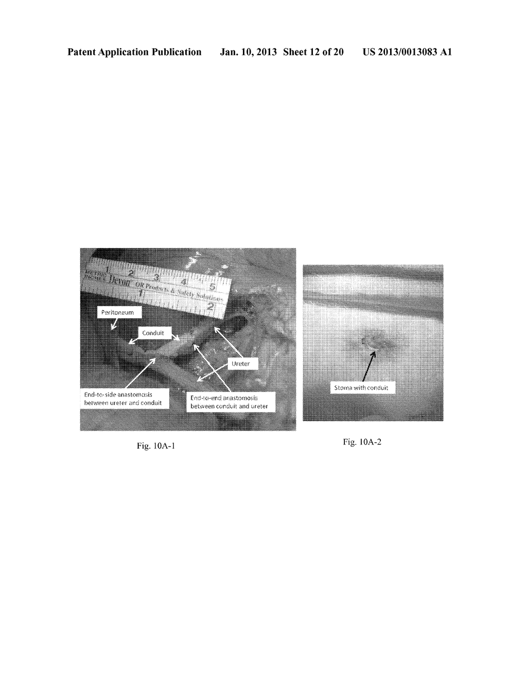 Tissue-Engineered Constructs - diagram, schematic, and image 13