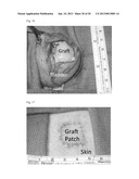 Tissue-Engineered Constructs diagram and image