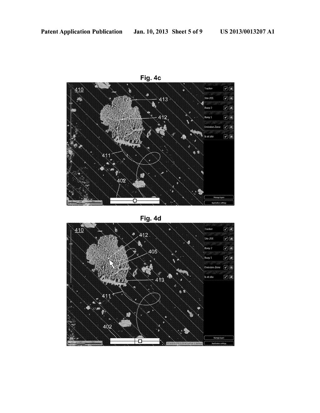 SUPPORT SYSTEM FOR USE WHEN MANAGING ICE - diagram, schematic, and image 06