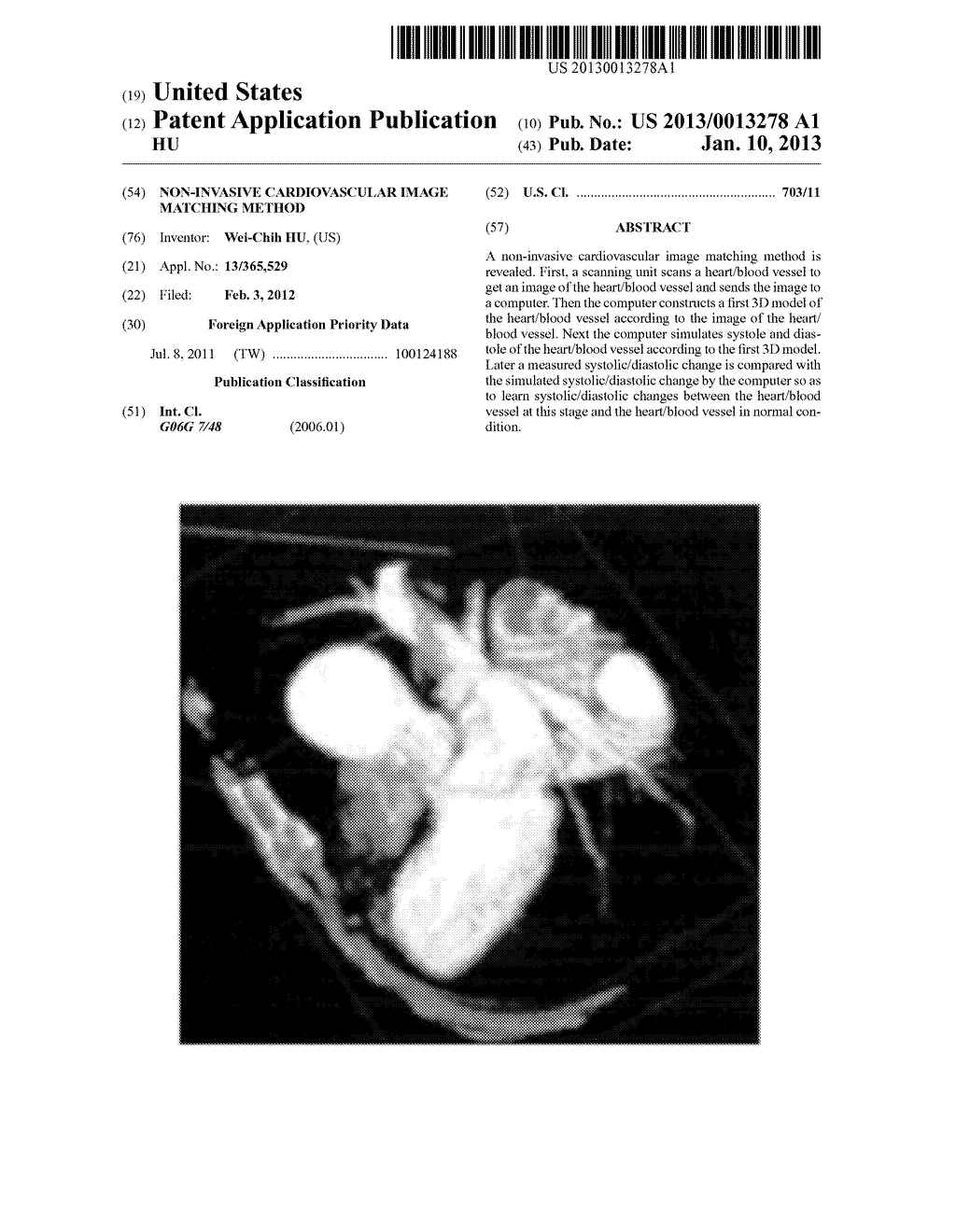 NON-INVASIVE CARDIOVASCULAR IMAGE MATCHING METHOD - diagram, schematic, and image 01