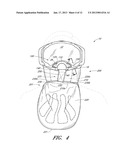 DETACHABLE FACEMASK FRAME AND FACEMASK FOR A GOGGLEAANM Castro; James NelsonAACI Laguna NiguelAAST CAAACO USAAGP Castro; James Nelson Laguna Niguel CA USAANM Moritz; Hans KarstenAACI Foothill RanchAAST CAAACO USAAGP Moritz; Hans Karsten Foothill Ranch CA USAANM Jones; Casey AaronAACI OceansideAAST CAAACO USAAGP Jones; Casey Aaron Oceanside CA US diagram and image