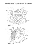 DETACHABLE FACEMASK FRAME AND FACEMASK FOR A GOGGLEAANM Castro; James NelsonAACI Laguna NiguelAAST CAAACO USAAGP Castro; James Nelson Laguna Niguel CA USAANM Moritz; Hans KarstenAACI Foothill RanchAAST CAAACO USAAGP Moritz; Hans Karsten Foothill Ranch CA USAANM Jones; Casey AaronAACI OceansideAAST CAAACO USAAGP Jones; Casey Aaron Oceanside CA US diagram and image