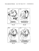 COMPLEMENTARY AND ADJUSTABLE PROTECTIVE SYSTEM diagram and image