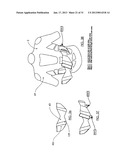 COMPLEMENTARY AND ADJUSTABLE PROTECTIVE SYSTEM diagram and image