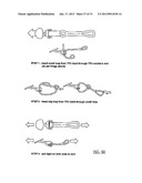 COMPLEMENTARY AND ADJUSTABLE PROTECTIVE SYSTEM diagram and image