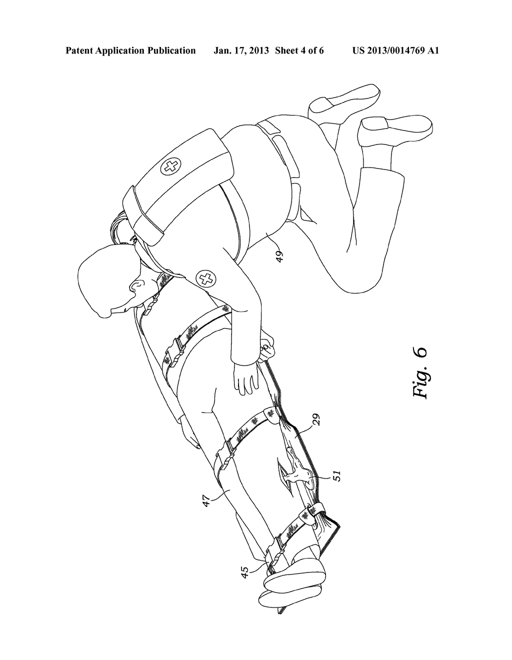 BACKBOARD COVER AND METHODS OF COVERING A BACKBOARD - diagram, schematic, and image 05