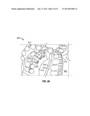 INNOVATIVE CUTTING ELEMENT AND CUTTING STRUCTURE USING SAME diagram and image