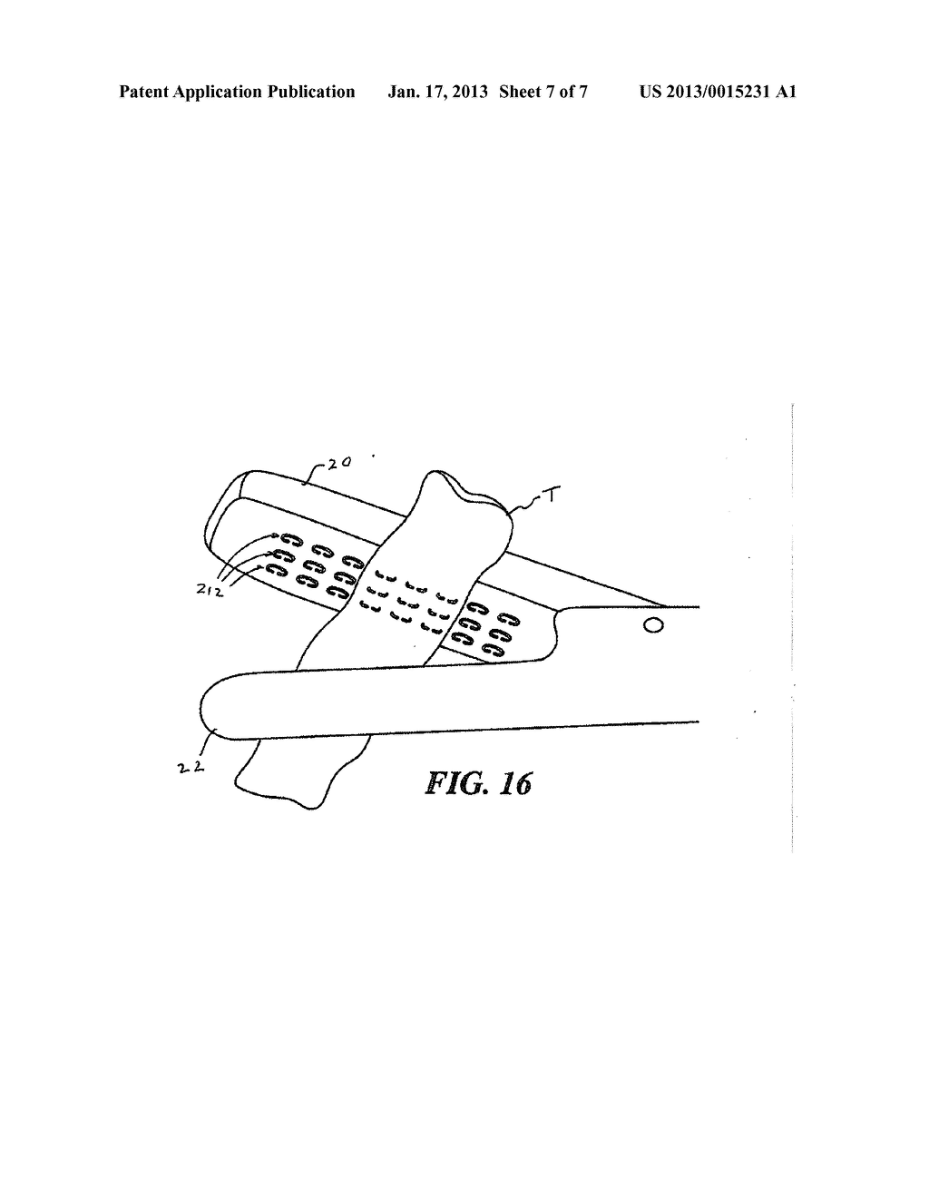 LOOSE STAPLES REMOVAL SYSTEMAANM Kostrzewski; StanislawAACI NewtownAAST CTAACO USAAGP Kostrzewski; Stanislaw Newtown CT US - diagram, schematic, and image 08