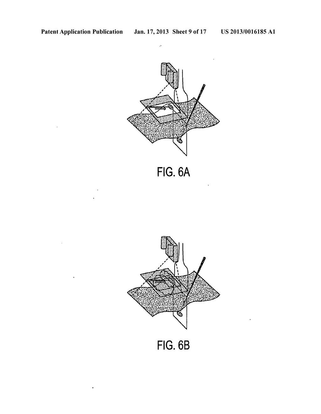 LOW-COST IMAGE-GUIDED NAVIGATION AND INTERVENTION SYSTEMS USING     COOPERATIVE SETS OF LOCAL SENSORS - diagram, schematic, and image 10